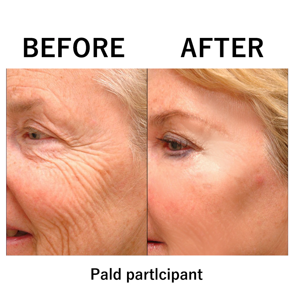 đ„ăOfficial Brand StoreăHZA Instant FIRMx Temporary Face Tightenerâ 87% OFF!
