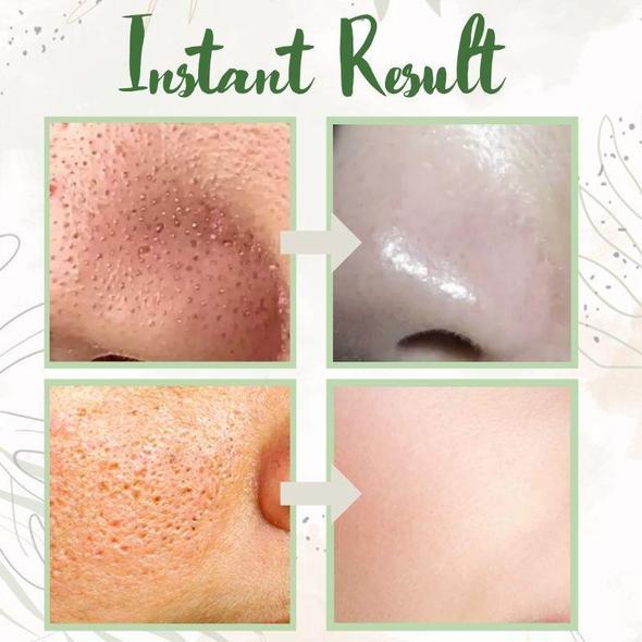 (🔥LAST DAY SALE-80% OFF) Final Sale -LOVILDS Green Tea Deep Cleanse Mask