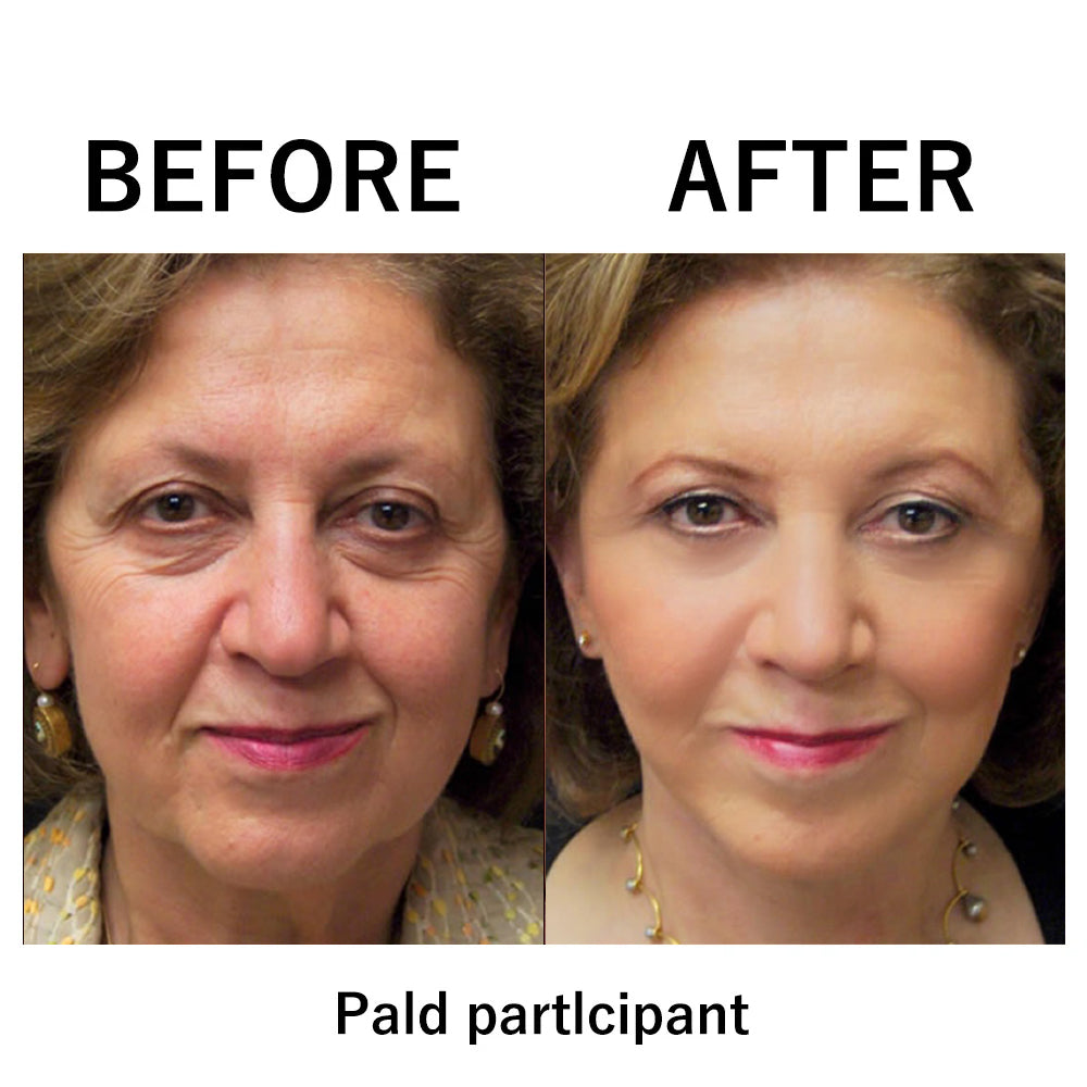 đ„ăOfficial Brand StoreăHZA Instant FIRMx Temporary Face Tightenerâ 87% OFF!