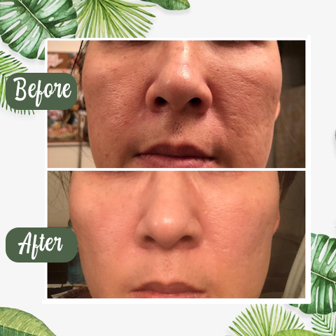 (🔥LAST DAY SALE-80% OFF) Final Sale -LOVILDS Green Tea Deep Cleanse Mask