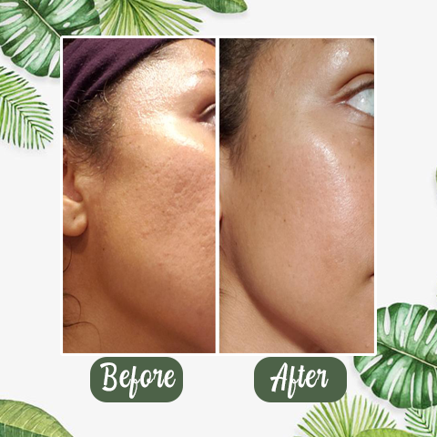 (🔥LAST DAY SALE-80% OFF) Final Sale -LOVILDS Green Tea Deep Cleanse Mask